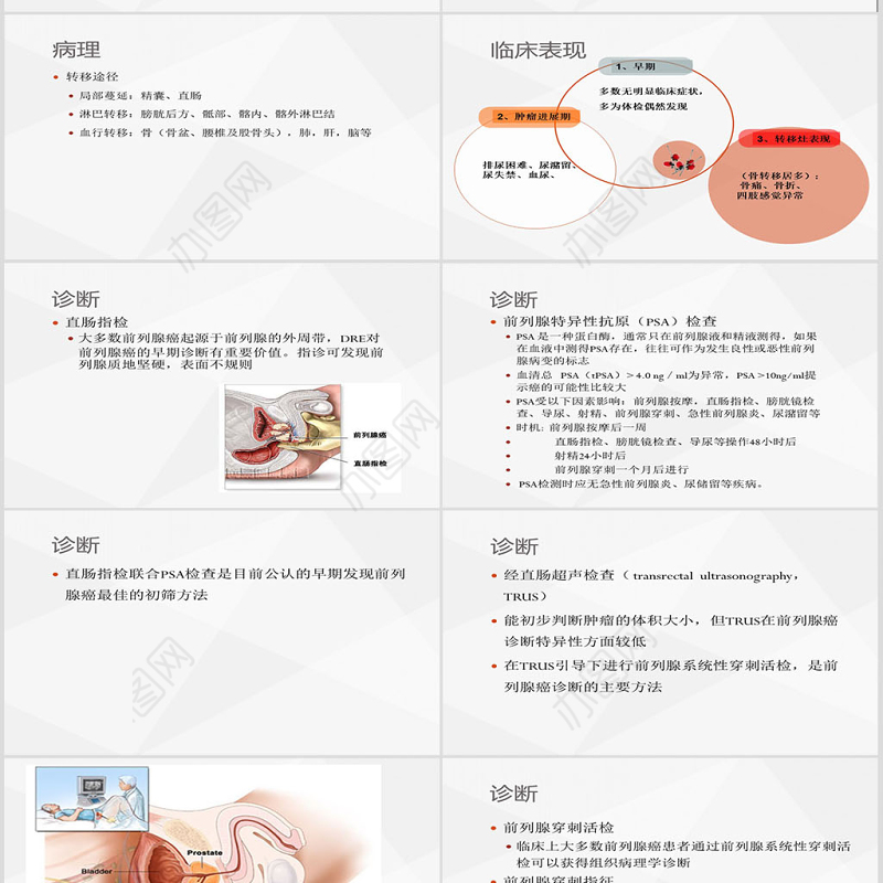 前列腺癌大学课件PPT