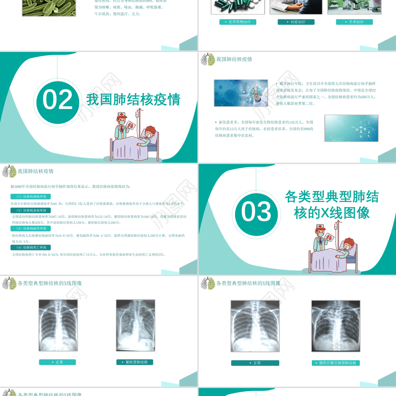 2022肺结核的护理PPT简约医疗风肺结核护理通用PPT