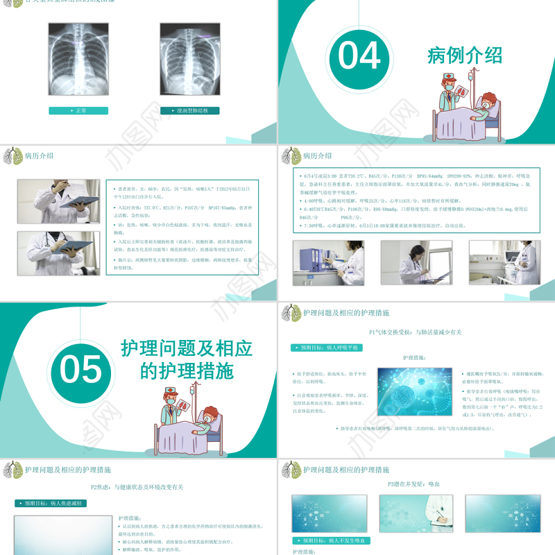 2022肺结核的护理PPT简约医疗风肺结核护理通用PPT
