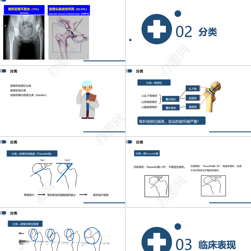 2022股骨颈骨折的护理PPT清新简约医学护理通用PPT