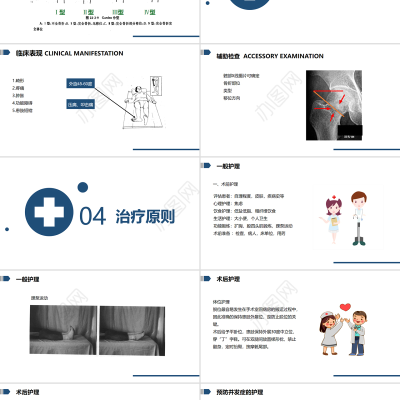 2022股骨颈骨折的护理PPT清新简约医学护理通用PPT