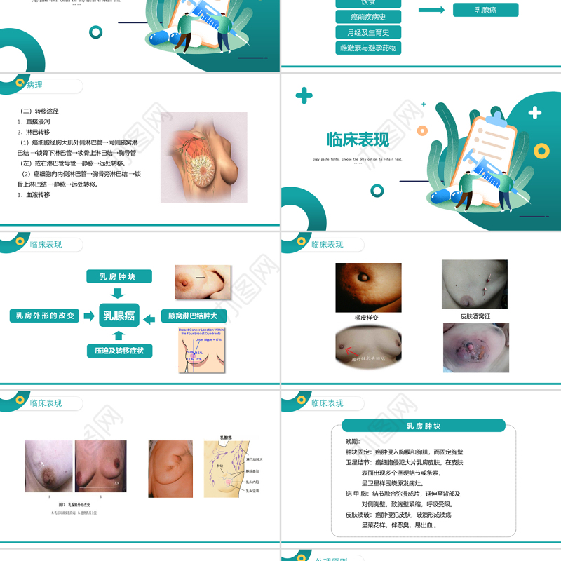 2022乳腺癌术后护理查房PPT清新医疗风护理查房通用PPT
