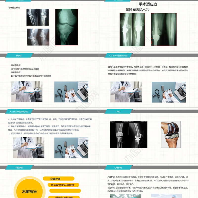 2022膝关节置换术后护理查房PPT商务简约护理查房必备PPT