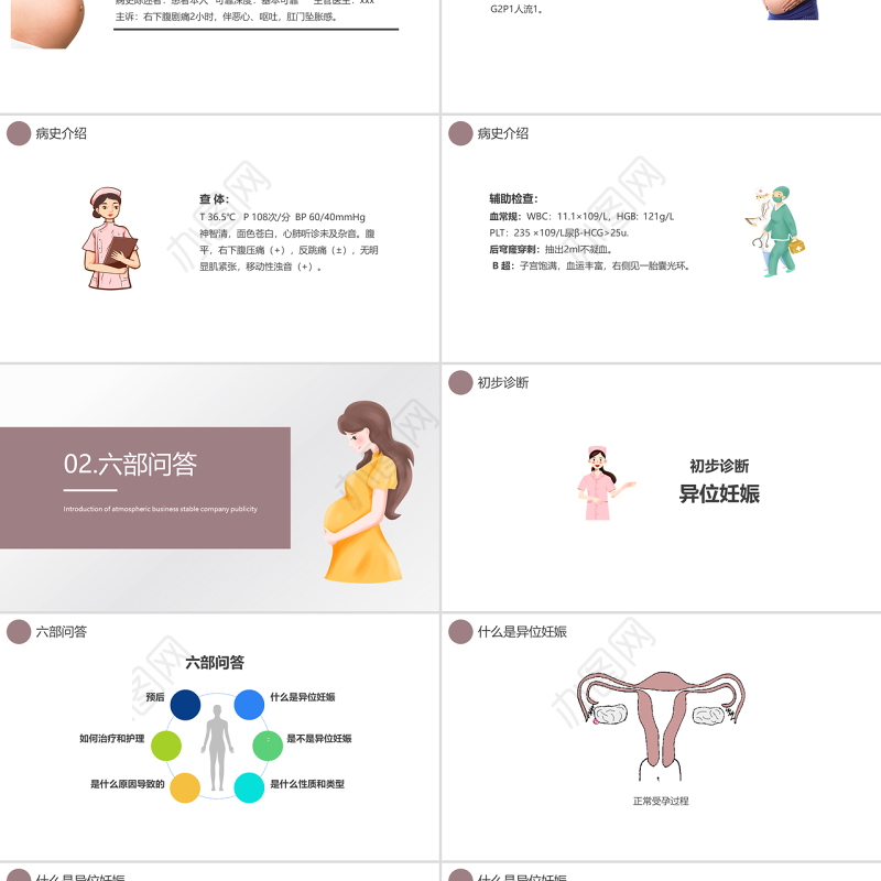2022异位妊娠护理PPT创意清新医学护理通用PPT