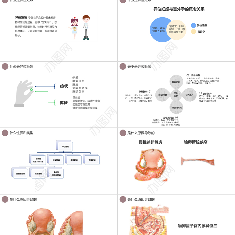 2022异位妊娠护理PPT创意清新医学护理通用PPT
