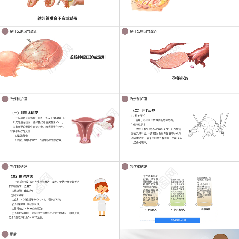2022异位妊娠护理PPT创意清新医学护理通用PPT