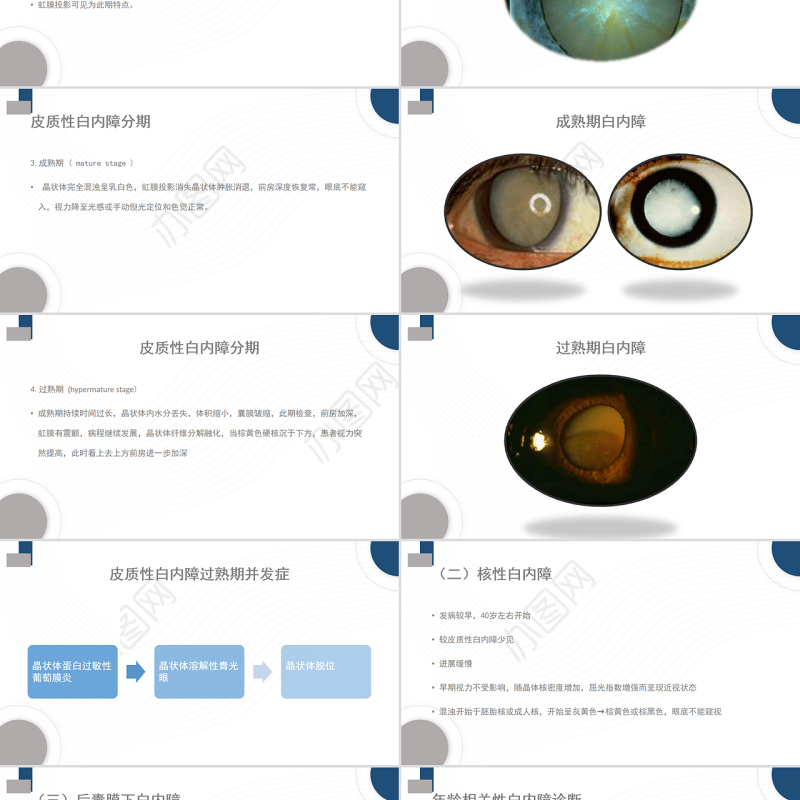 2022白内障护理教学查房PPT大气清新护理查房通用PPT