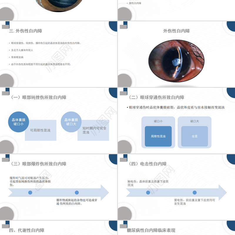 2022白内障护理教学查房PPT大气清新护理查房通用PPT