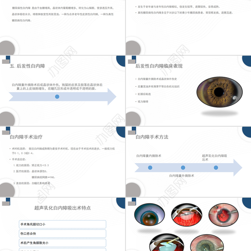 2022白内障护理教学查房PPT大气清新护理查房通用PPT