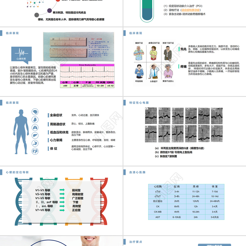 2022急性心肌梗死医疗护理查房PPT淡蓝清新护理查房通用PPT