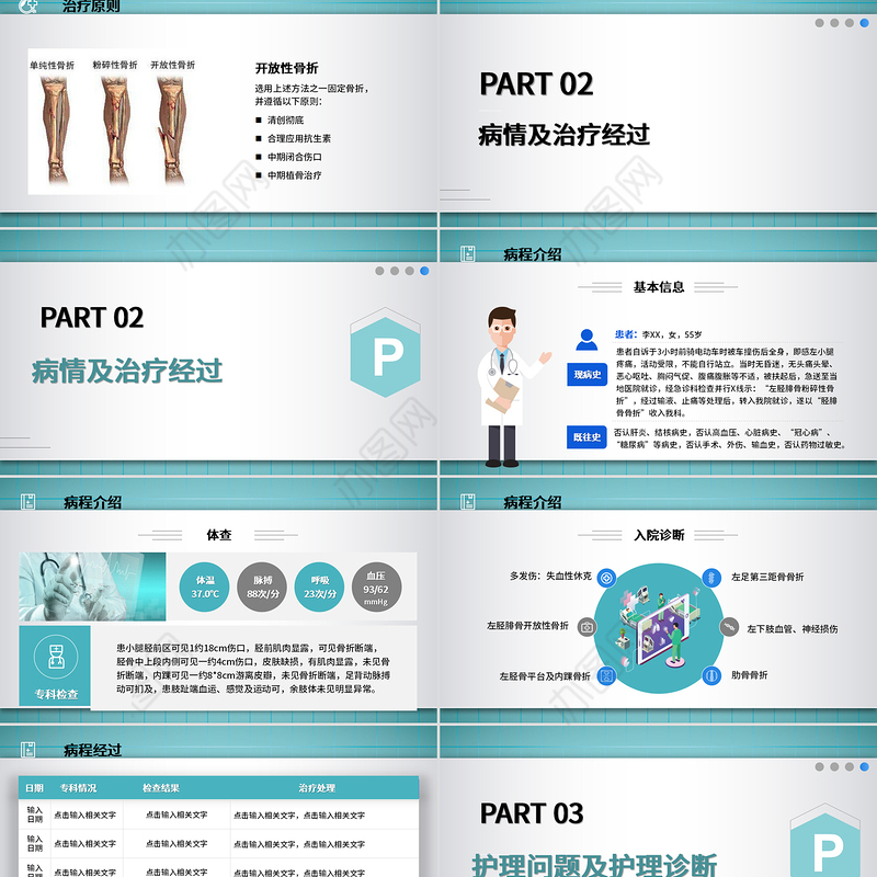 2022胫腓骨骨折护理PPT简约个性医学护理通用PPT