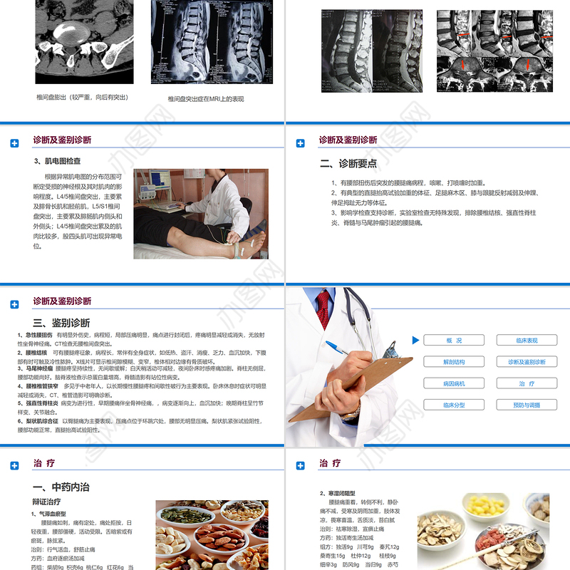 2022腰椎间盘突出症诊断与治疗PPT清新商务医疗风医学通用PPT模板