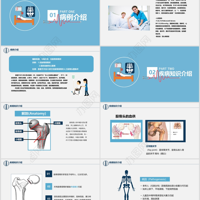 股骨颈骨折护理查房ppt