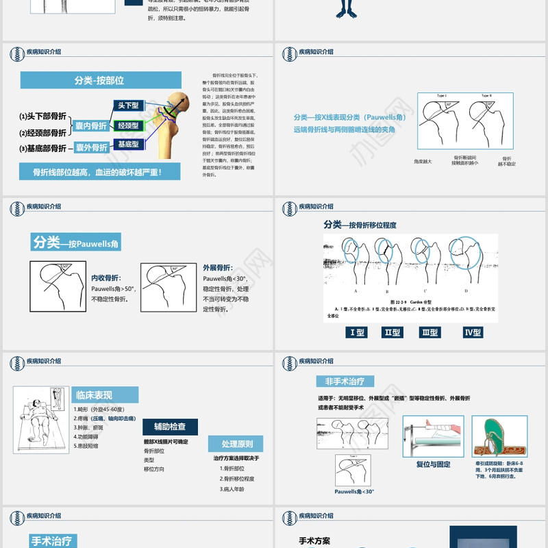 股骨颈骨折护理查房ppt