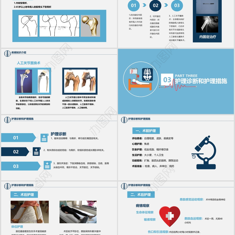 股骨颈骨折护理查房ppt