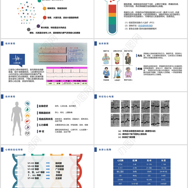 急性心肌梗死护理查房PPT