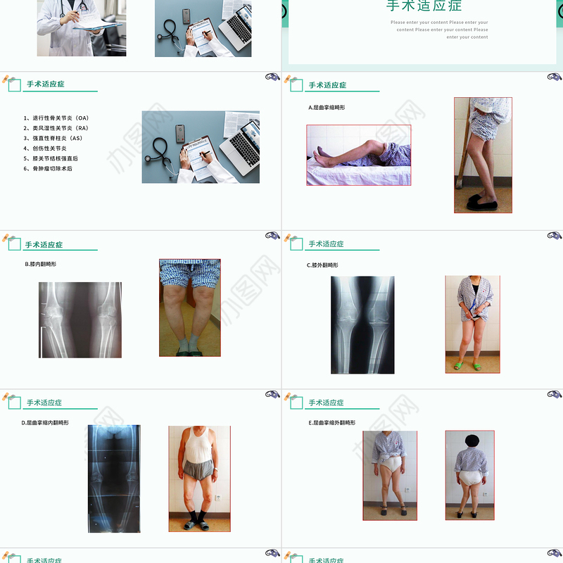 2022膝关节置换术后护理查房PPT清新创意医疗风术后护理通用PPT