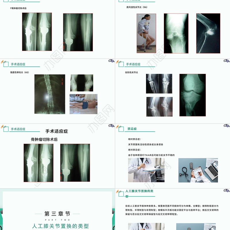 2022膝关节置换术后护理查房PPT清新创意医疗风术后护理通用PPT