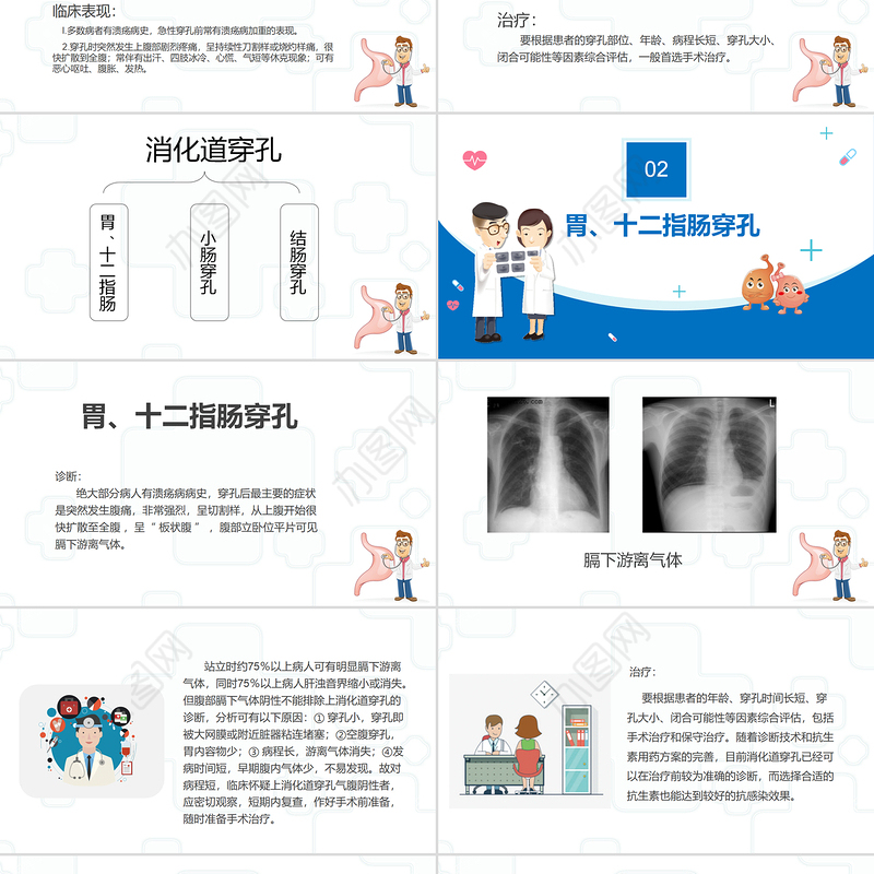 2022消化道穿孔医疗课件知识PPT医疗教学各种疾病医理PPT模板
