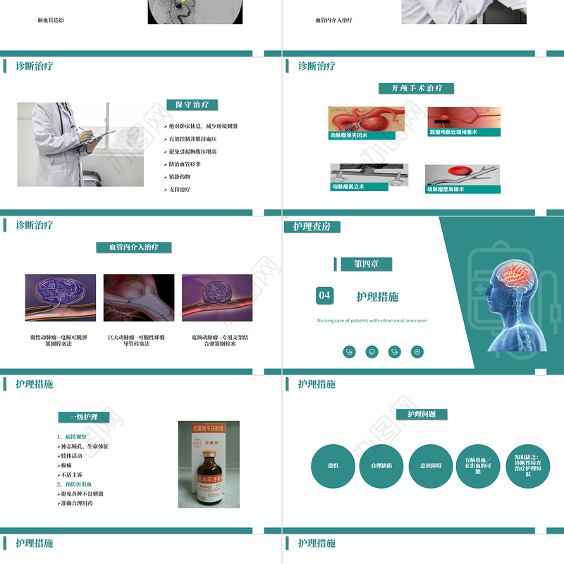 2022颅内动脉瘤护理查房PPT商务简约护理查房通用PPT