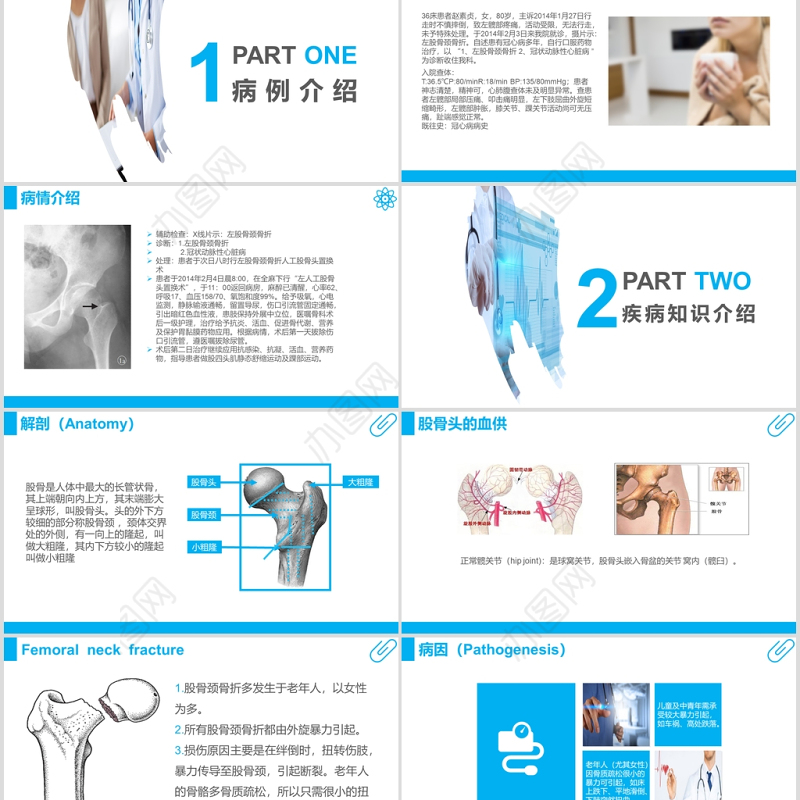 股骨颈骨折护理查房ppt