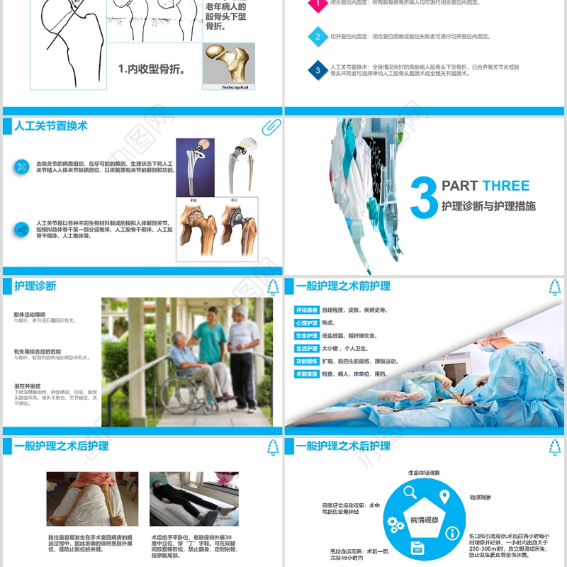 股骨颈骨折护理查房ppt