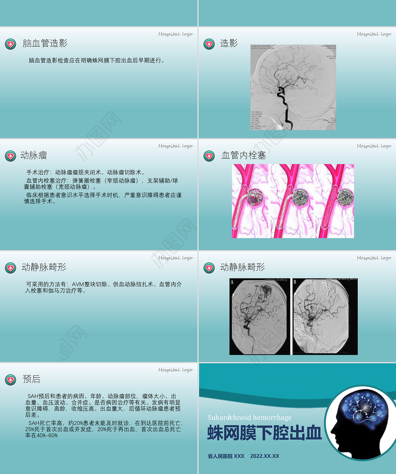 2022蛛网膜下腔出血PPT创意简约医疗教学各种疾病医理PPT模板